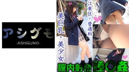 518ASGM-029