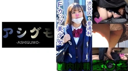 518ASGM-028