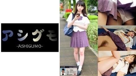 518ASGM-002